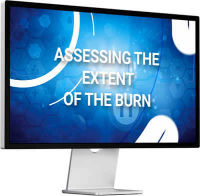 Video Download - Assessing the Extent of the Burn (Adult) VID-ATEOTB-ADT
